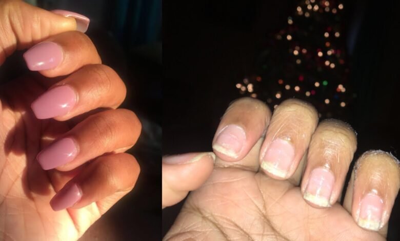 How to Safely Remove Gel Nails